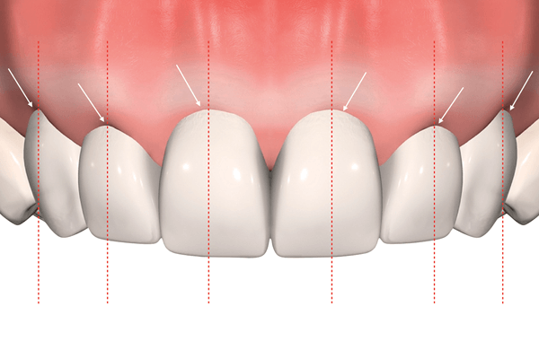 Oito passos para o planejamento estético em prótese dentária