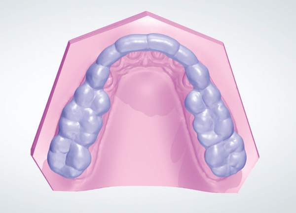 Relações maxila e mandíbula em dentados 